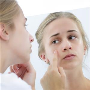 Browse Acne Acne