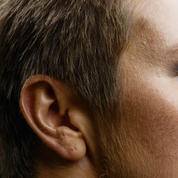 Browse Glue Ear Glue Ear