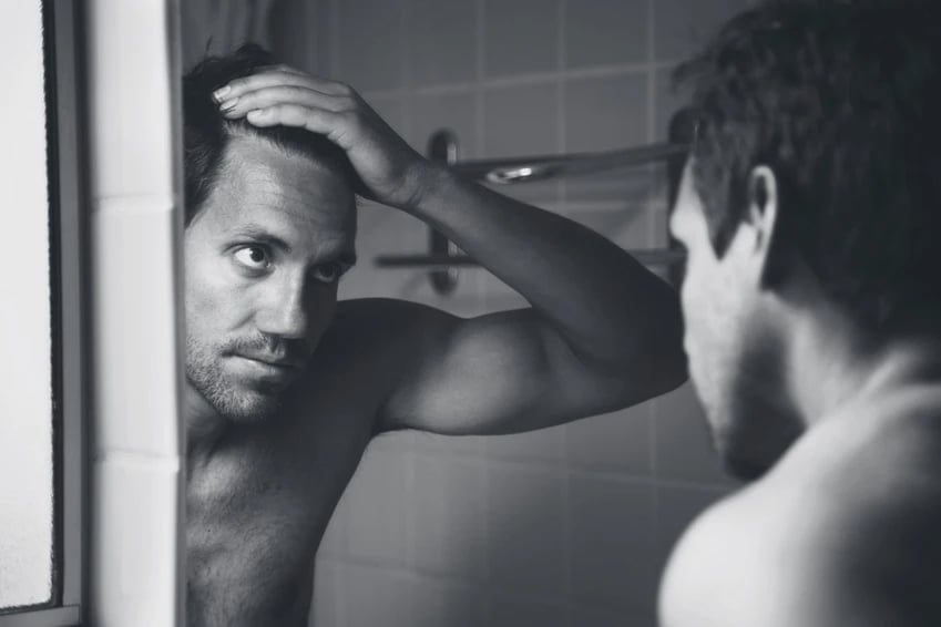 Which Hair Loss Treatment is Right For Me? 